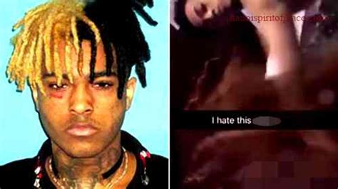 xxx tentacion autopsy photo|Autopsyfiles.org 